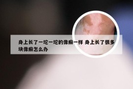 身上长了一坨一坨的像癣一样 身上长了很多块像癣怎么办
