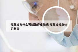 煤焦油为什么可以治疗皮肤病 煤焦油对身体的危害