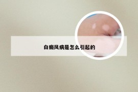 白癜风病是怎么引起的