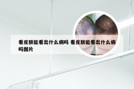 看皮肤能看出什么病吗 看皮肤能看出什么病吗图片