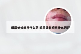 眼眉处长癣用什么药 眼眉处长癣用什么药好