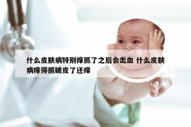 什么皮肤病特别痒抓了之后会出血 什么皮肤病痒得抓破皮了还痒