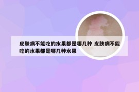 皮肤病不能吃的水果都是哪几种 皮肤病不能吃的水果都是哪几种水果