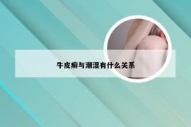 牛皮癣与潮湿有什么关系
