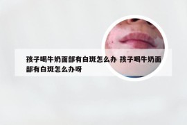 孩子喝牛奶面部有白斑怎么办 孩子喝牛奶面部有白斑怎么办呀