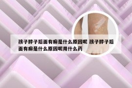 孩子脖子后面有癣是什么原因呢 孩子脖子后面有癣是什么原因呢用什么药