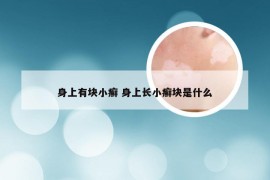 身上有块小癣 身上长小癣块是什么