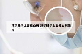 孩子肚子上出现白斑 孩子肚子上出现白斑图片
