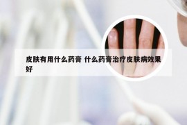 皮肤有用什么药膏 什么药膏治疗皮肤病效果好