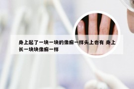 身上起了一块一块的像癣一样头上也有 身上长一块块像癣一样