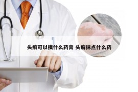 头癣可以摸什么药膏 头癣抹点什么药
