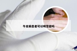 牛皮癣患者可以喝雪碧吗