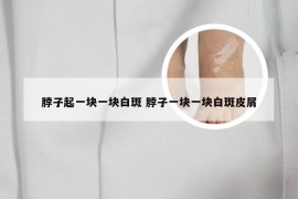 脖子起一块一块白斑 脖子一块一块白斑皮屑