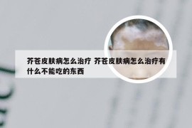 芥苍皮肤病怎么治疗 芥苍皮肤病怎么治疗有什么不能吃的东西