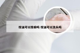 桉油可以擦癣吗 桉油可以洗头吗
