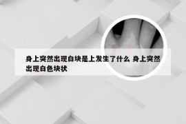 身上突然出现白块是上发生了什么 身上突然出现白色块状