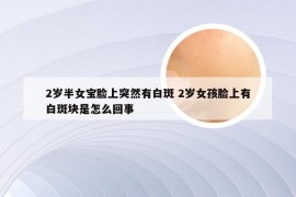 2岁半女宝脸上突然有白斑 2岁女孩脸上有白斑块是怎么回事