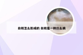 白班怎么形成的 白班是一种什么病