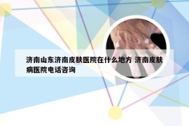 济南山东济南皮肤医院在什么地方 济南皮肤病医院电话咨询