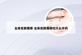 全身皮肤瘙痒 全身皮肤瘙痒吃什么中药