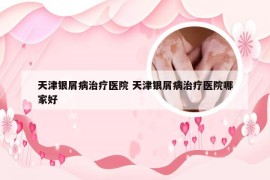 天津银屑病治疗医院 天津银屑病治疗医院哪家好