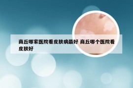 商丘哪家医院看皮肤病最好 商丘哪个医院看皮肤好