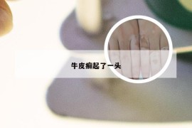 牛皮癣起了一头