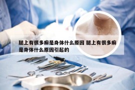 腿上有很多癣是身体什么原因 腿上有很多癣是身体什么原因引起的