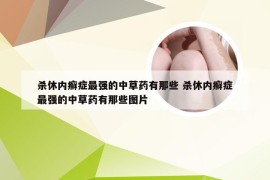 杀休内癣症最强的中草药有那些 杀休内癣症最强的中草药有那些图片