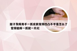 腿子发痒用手一抓皮肤变得凹凸不平是怎么了 觉得腿痒一抓就一片红