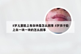 8岁儿童脸上有白块是怎么回事 8岁孩子脸上白一块一块的怎么回事