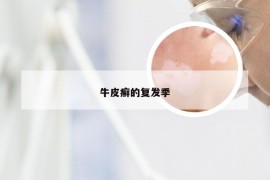 牛皮癣的复发季