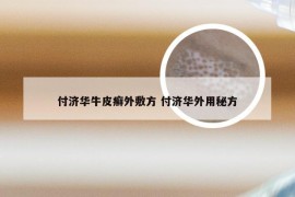 付济华牛皮癣外敷方 付济华外用秘方