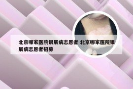 北京哪家医院银屑病志愿者 北京哪家医院银屑病志愿者招募
