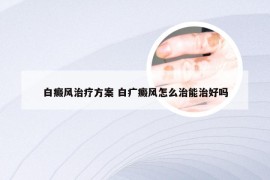 白癜风治疗方案 白疒癜风怎么治能治好吗