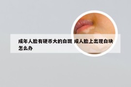 成年人脸有硬币大的白斑 成人脸上出现白块怎么办