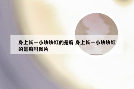 身上长一小块块红的是癣 身上长一小块块红的是癣吗图片