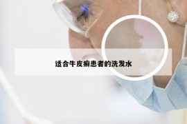 适合牛皮癣患者的洗发水