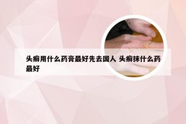 头癣用什么药膏最好先去国人 头癣抹什么药最好