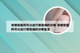 有哪些医院可以进行银屑病的诊断 有哪些医院可以进行银屑病的诊断鉴定
