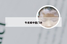 牛皮癣中医门诊