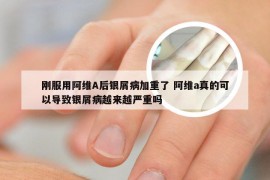 刚服用阿维A后银屑病加重了 阿维a真的可以导致银屑病越来越严重吗
