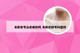 阜新有专冶皮癣的吗 阜新皮肤专科医院