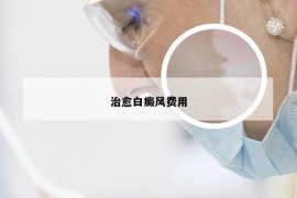 治愈白癜风费用