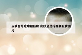 皮肤全是疙瘩颗粒状 皮肤全是疙瘩颗粒状图片