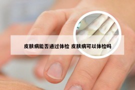 皮肤病能否通过体检 皮肤病可以体检吗