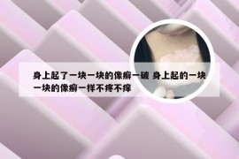 身上起了一块一块的像癣一破 身上起的一块一块的像癣一样不疼不痒