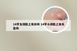 14岁女孩脸上有白块 14岁小孩脸上有白色块