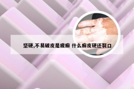 坚硬,不易破皮是疲癣 什么癣皮硬还裂口