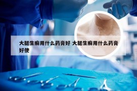 大腿生癣用什么药膏好 大腿生癣用什么药膏好使